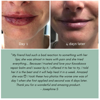 Kawakawa Repair Balm